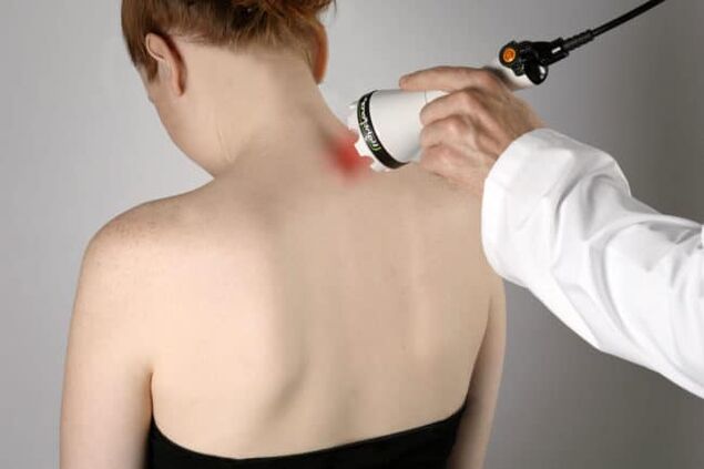 Для боротьби з болем у спині в області лопаток використовується лазеротерапія