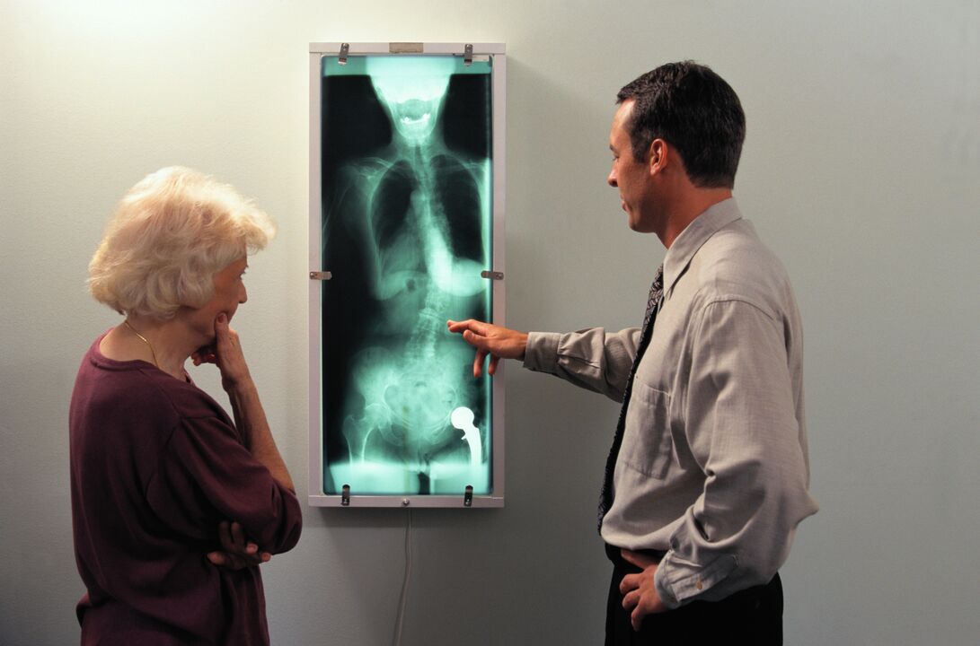 рентген діагностика при болях у тазостегновому суглобі